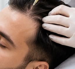 Fuller, Stronger Hair — gfc & prp at Paradise Wellness