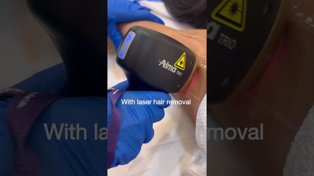 Hair-Free Skin with Laser Hair Removal at Paradise Wellness Clinic, Vasant Vihar 🌞 #SmoothSkinGoals — video thumbnail