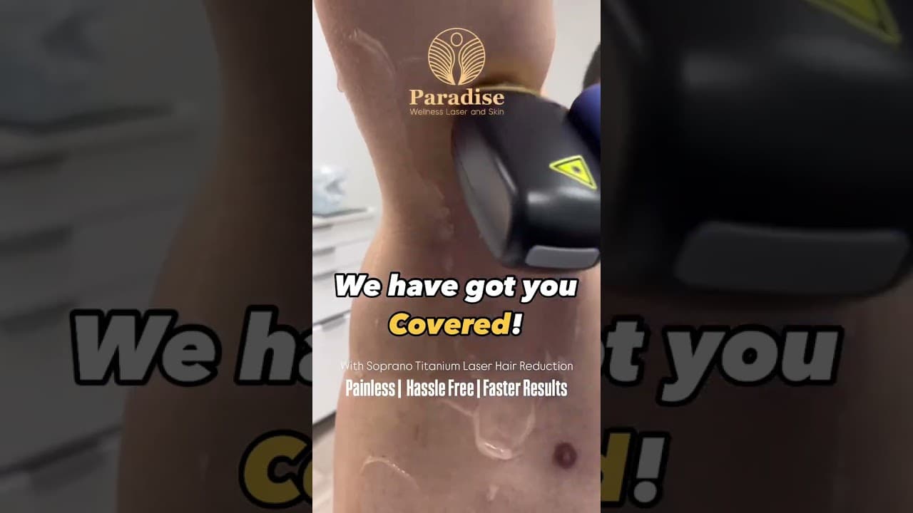 #1 Laser Hair Removal with Soprano Titanium ⚡ Painless & Permanent | Paradise Wellness Delhi — video thumbnail