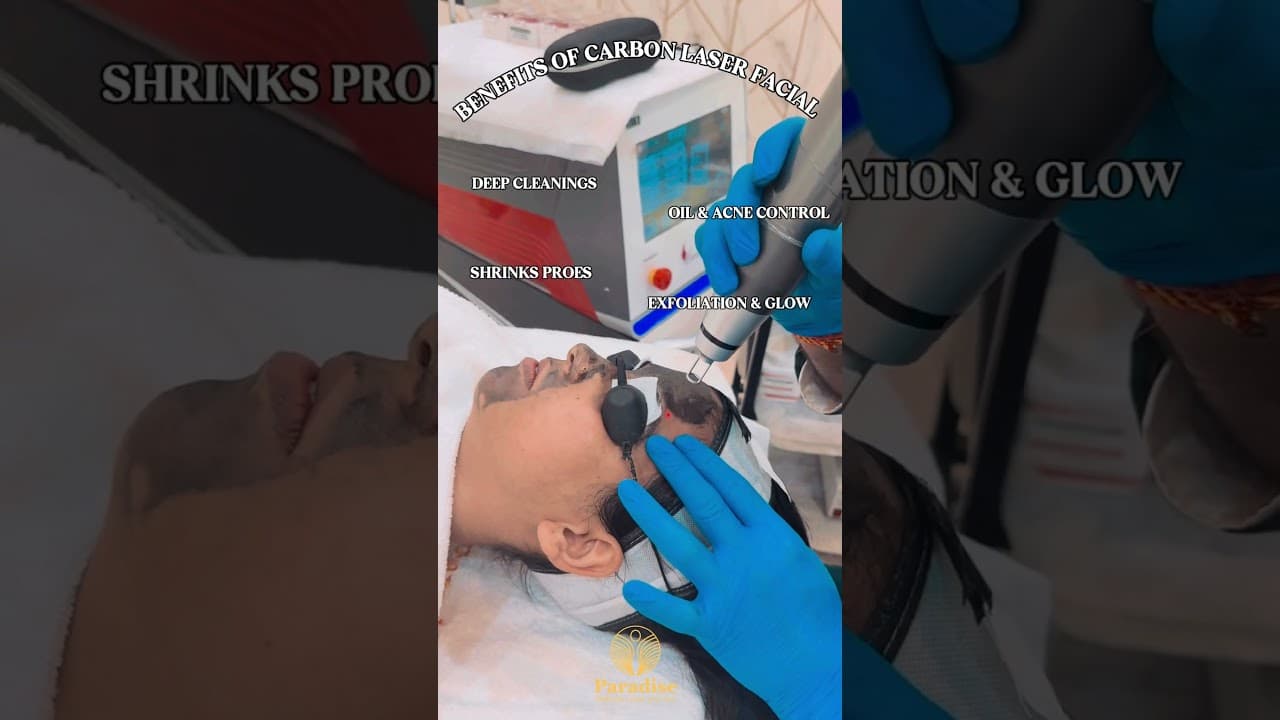 Carbon Laser Facial for Clear Glowing Skin ✨ | Acne, Pores & Pigmentation Gone!  #carbonfacial — video thumbnail