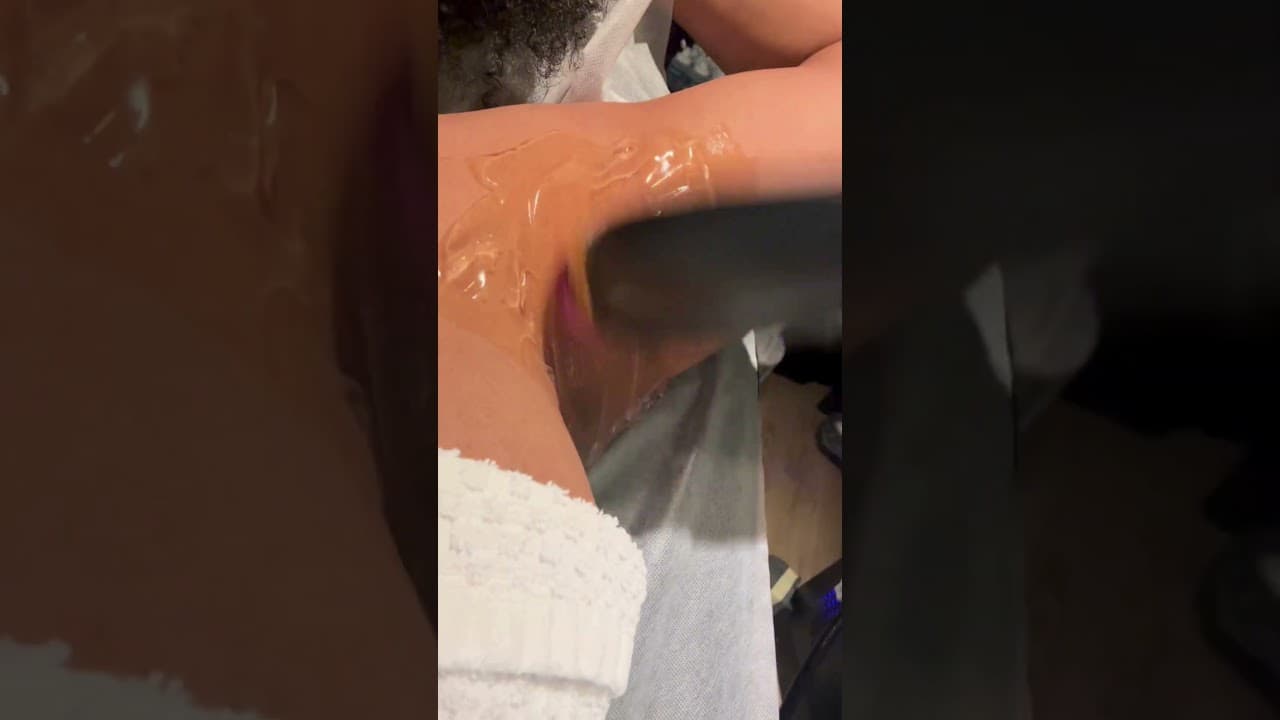 PERMANENT Laser Hair Removal at Paradise Wellness | Safe, Painless & Affordable! — video thumbnail