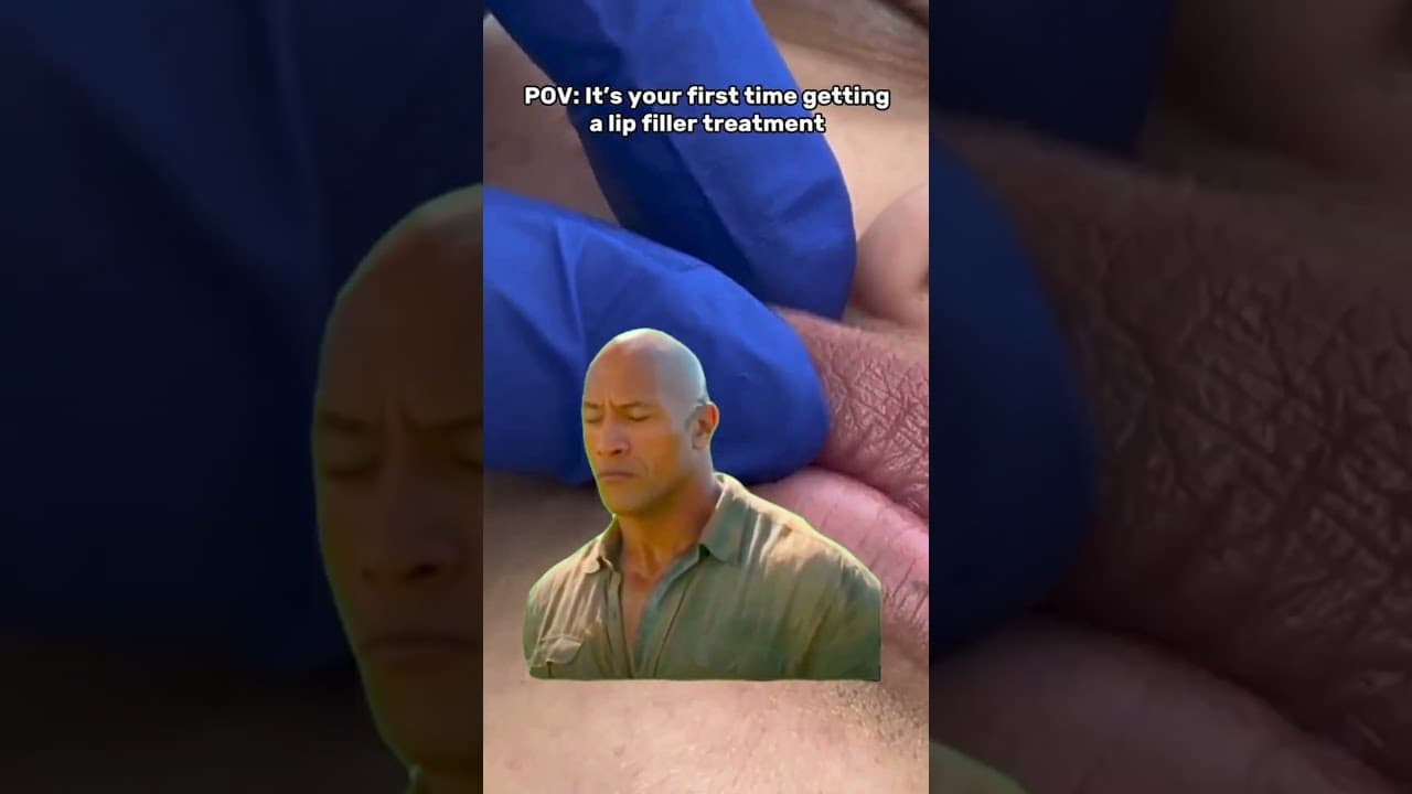 POV: Your First Lip Filler Treatment 💋 | Reaction & Real Glow — video thumbnail