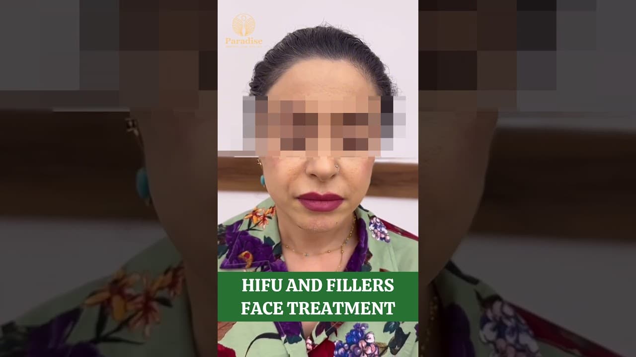 HIFU & Fillers Before & After Transformation | Look Younger & Glow Naturally! — video thumbnail