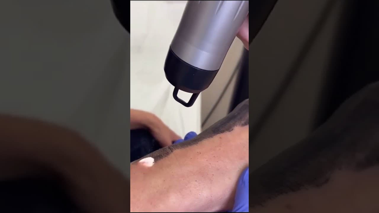 Hand Carbon Facial for Instant Glow | Skin Brightening & Tan Removal at Paradise Wellness  #glowup — video thumbnail