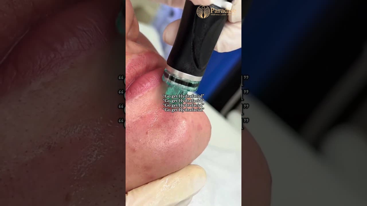 This Is Your Sign To Book A HydraFacial 💦 | Instant Glow At Paradise Wellness — video thumbnail