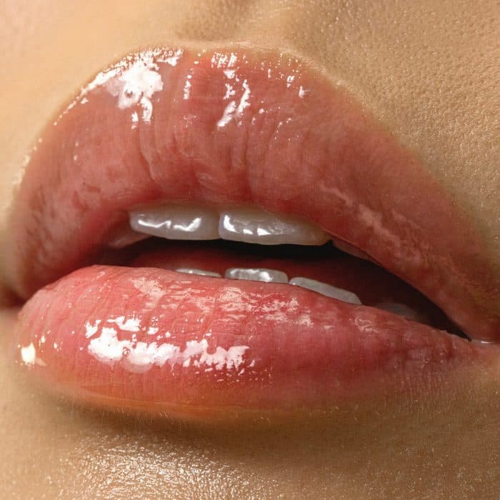 Lip Filler, Dermal Filler & Profhilo Aftercare Guide — aftercare at Paradise Wellness