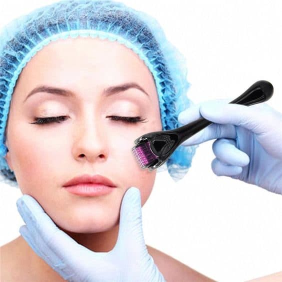 Microneedling & PRP Facial Aftercare: Day-by-Day Guide — aftercare guide