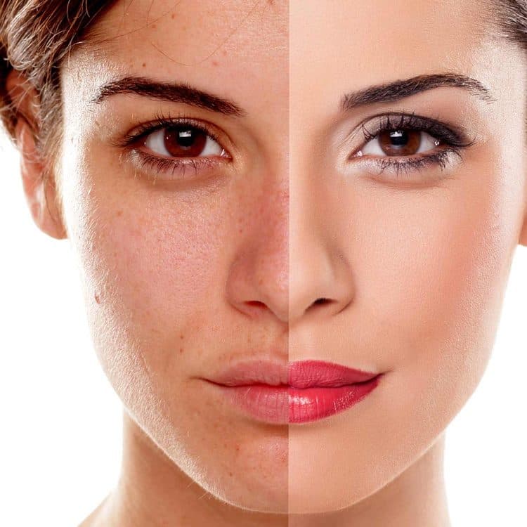 Chemical Peel, Cosmelan & BioRePeel Aftercare Guide — aftercare guide