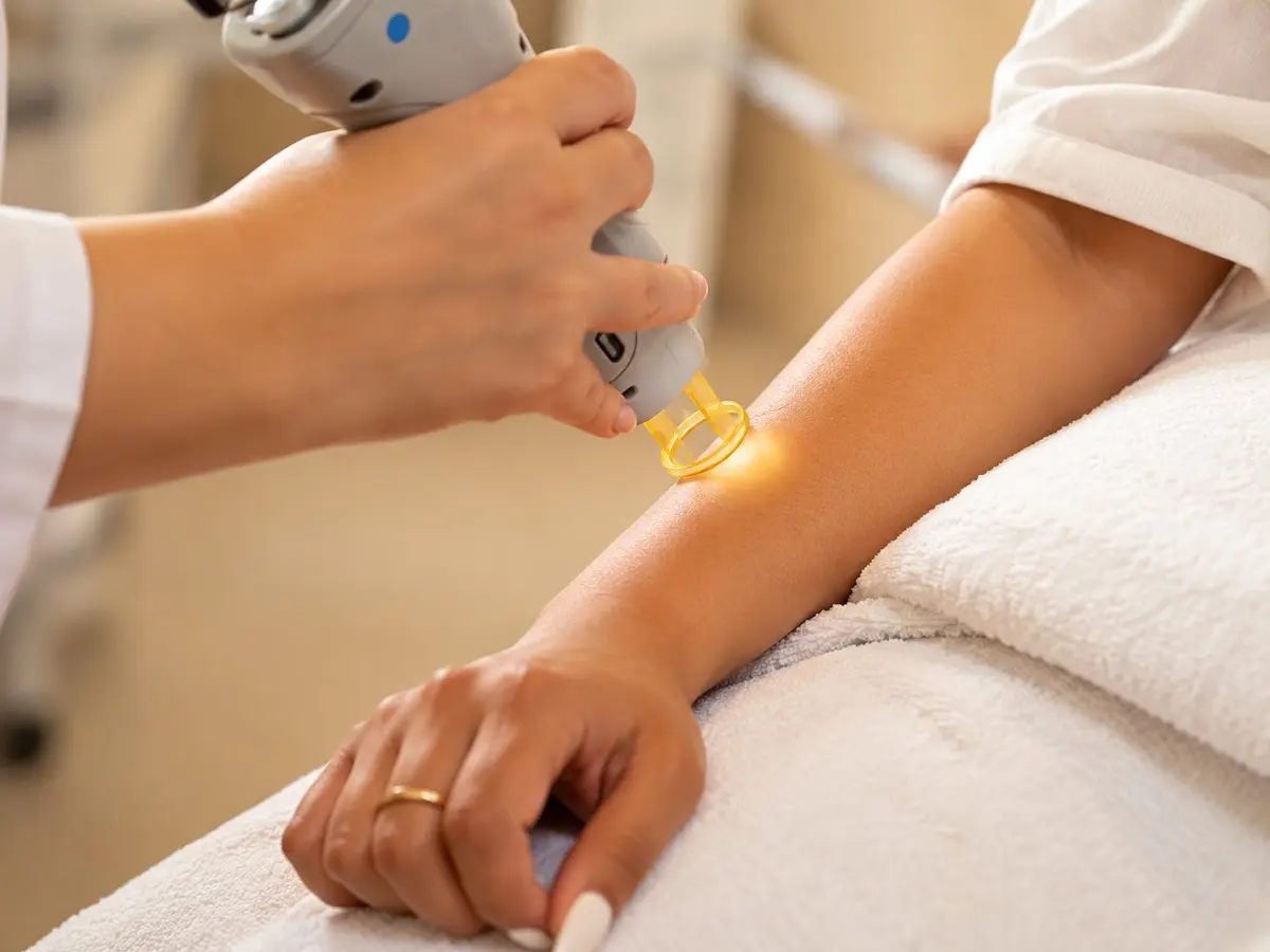 Body Laser Toning for dark underarms, lips & knees at Paradise Wellness