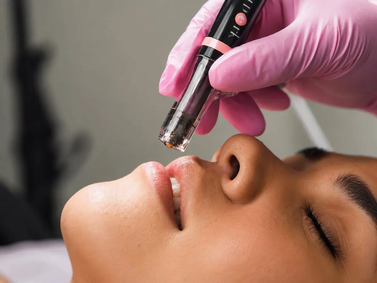 Lip Perk at Paradise Wellness