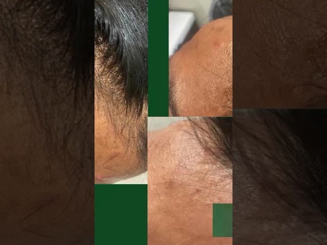 I Healed My HAIR LOSS in Just 30 Days — video thumbnail