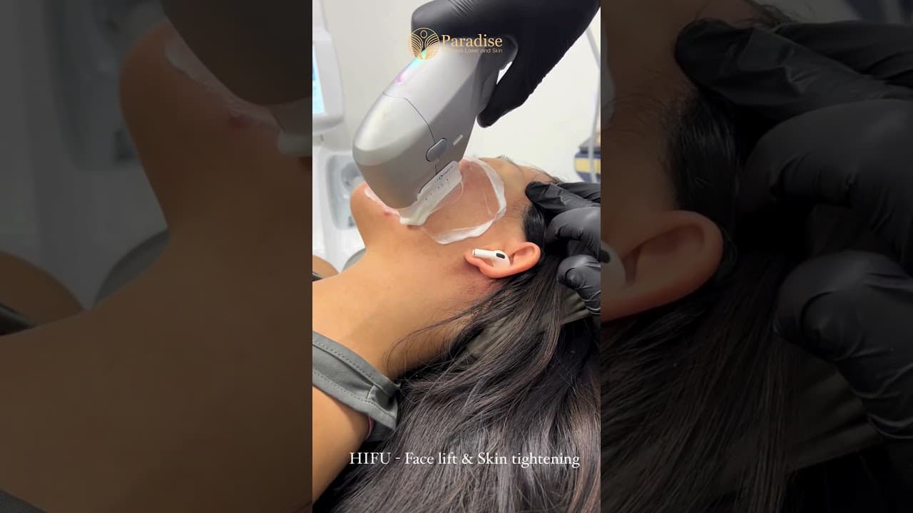 Instant Lift Without Surgery?! 💆♀️ HIFU Face Lift & Skin Tightening at Paradise Wellness — video thumbnail