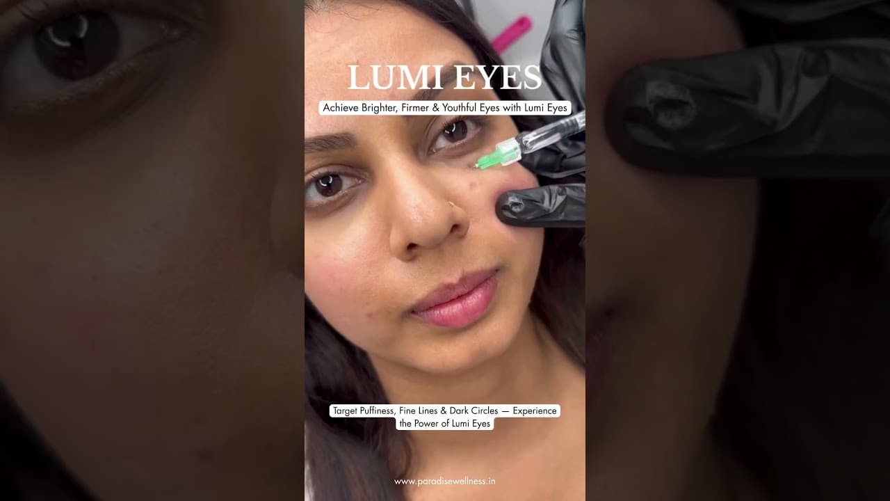 Lumi Eye Treatment Everything You Need to Know for Brighter, Younger-Looking Eyes — video thumbnail