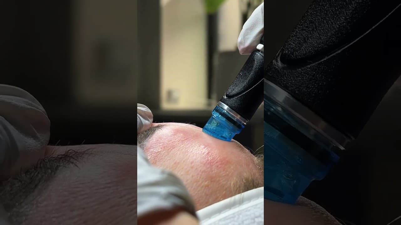 ASMR Luxury HydraFacial Experience Best Skin Glow Treatment at Paradise Wellness Clinic — video thumbnail