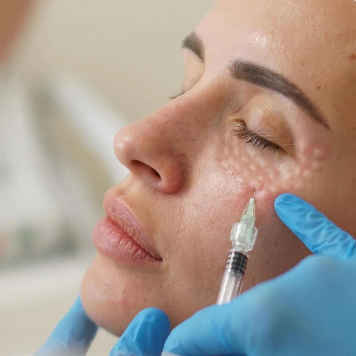 Injectables treatments at Paradise Wellness