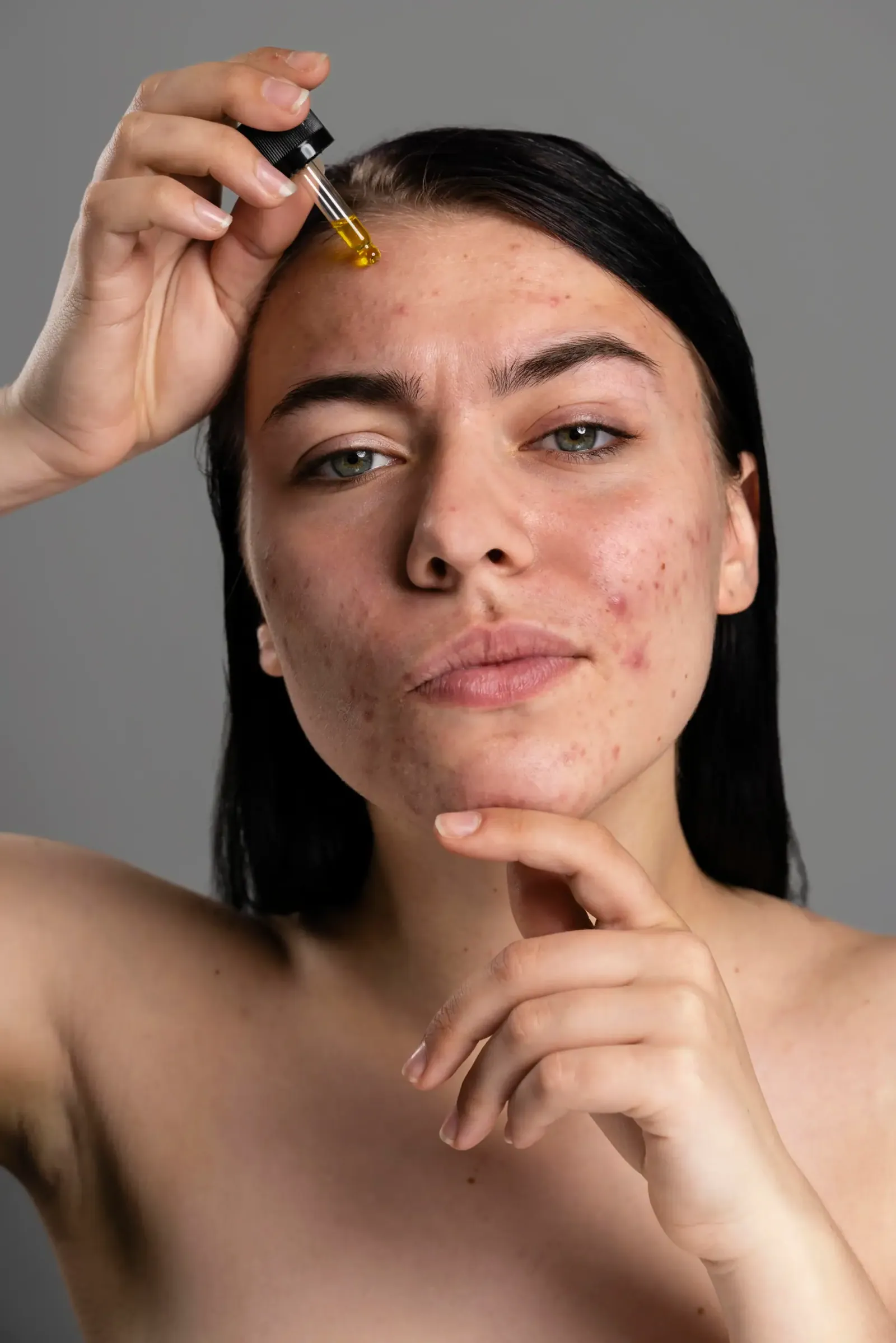 Monsoon Skin Care Hacks by Dr. Surabhi Sharma