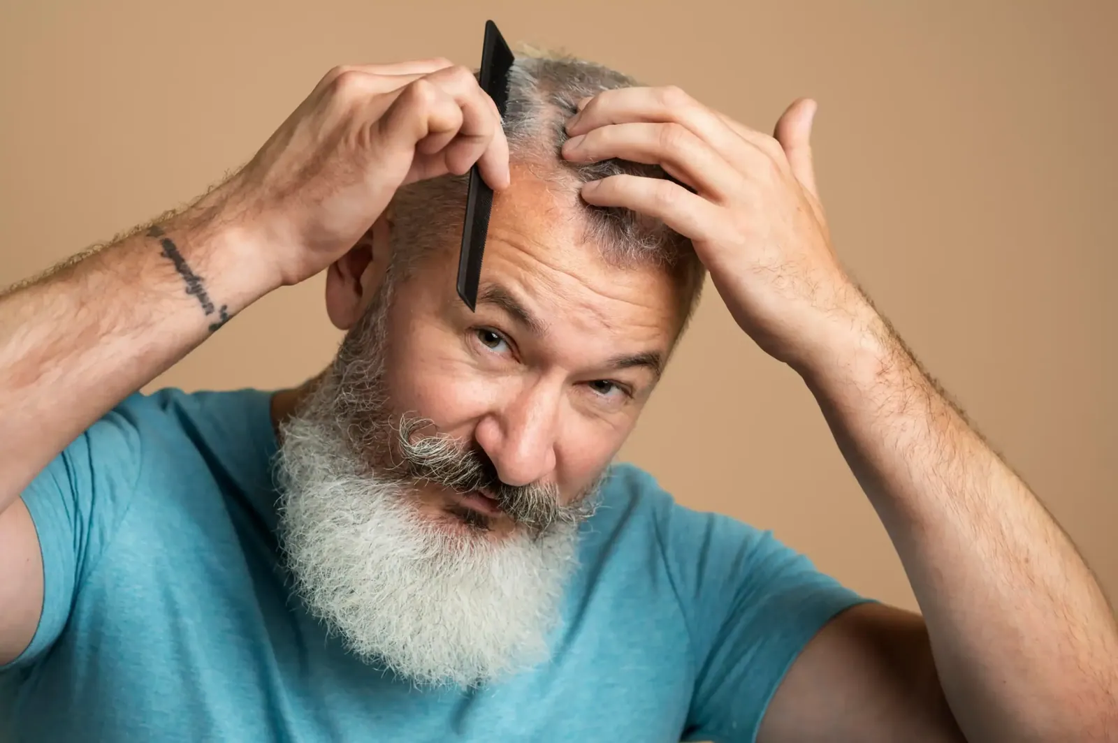 Hair Genex treatment in Delhi hair regrowth