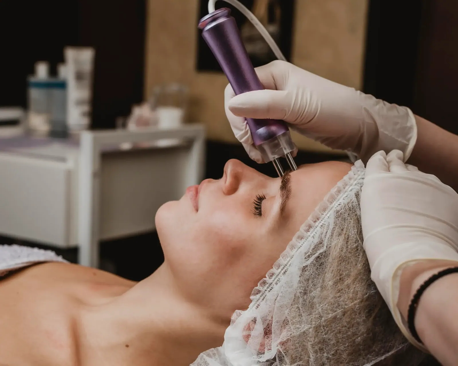 Microneedling with Exosomes