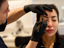 Eyebrow Transplant treatment at Paradise Wellness