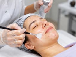 Glycolic Peel treatment at Paradise Wellness