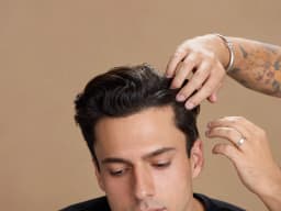 Hair Patch (Non-Surgical Hair Replacement) treatment at Paradise Wellness