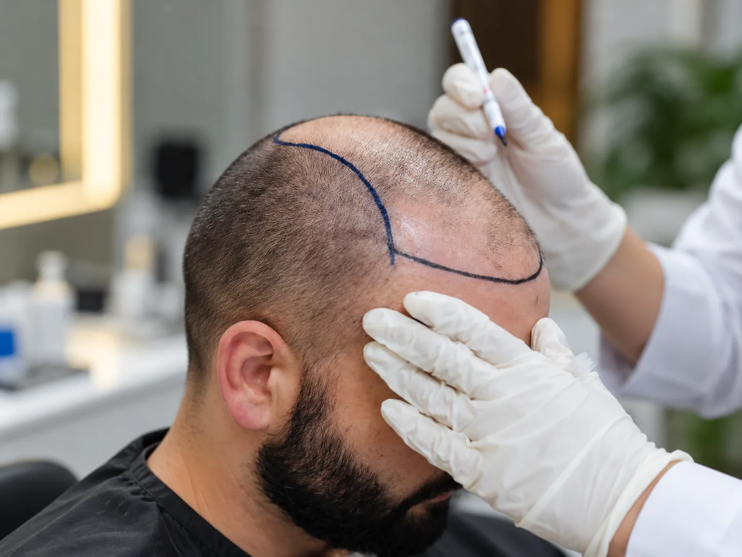 Hair Transplant Aftercare: Day by Day | Paradise Wellness — aftercare at Paradise Wellness