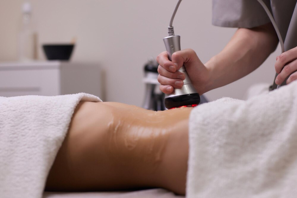 Best Cavitation RF Treatment in Delhi | Paradise Wellness