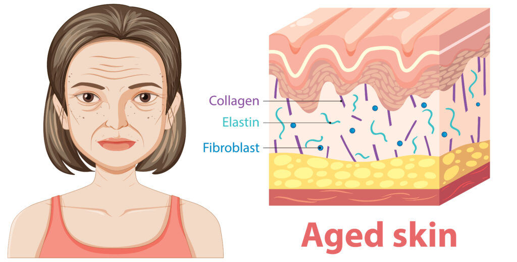 Anti-Aging Treatment Safety Guide Aged skin