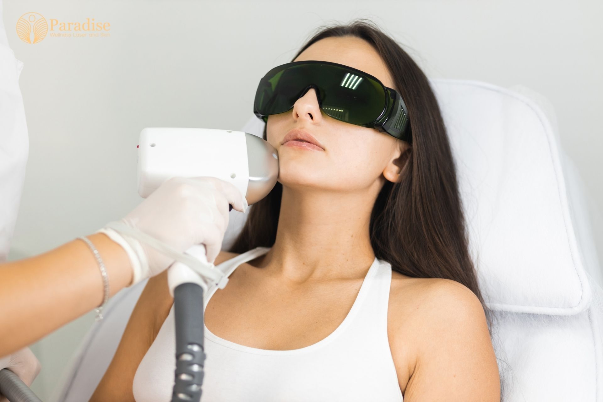 laser hair removal