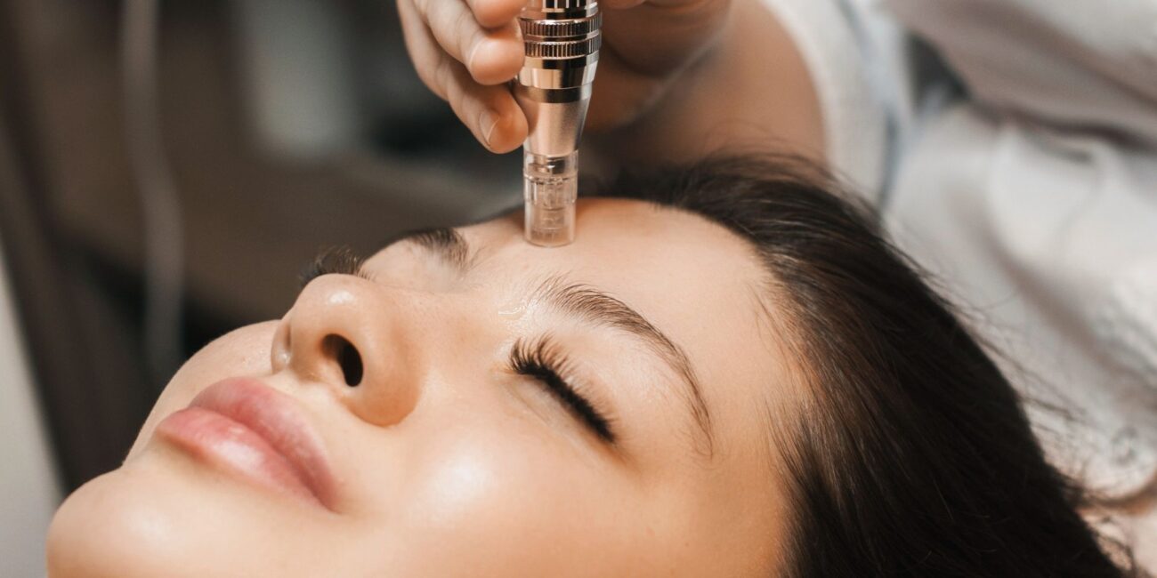 How Long Does It Take for Microneedling to Work?