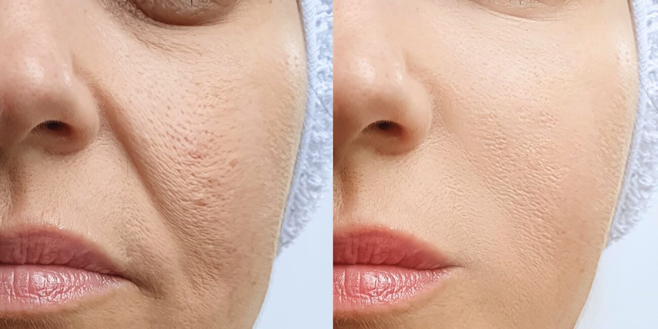 The Real Truth About Top Dermatologist-Recommended Skin Treatments