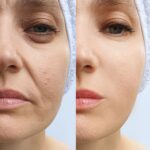 The Real Truth About Top Dermatologist-Recommended Skin Treatments