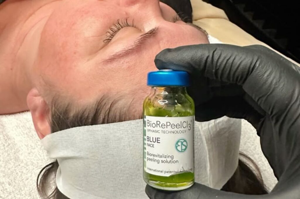 BioRePeel TCA peel for pigmentation and skin rejuvenation