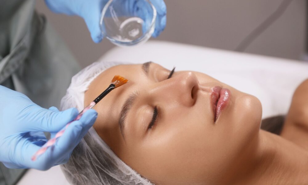 Best Treatment for Pigmentation: 5 Reasons BioRePeel Beats Chemical Peels for Glowing Skin