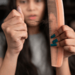Monsoon weather creates the perfect storm for scalp damage