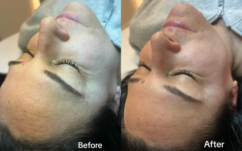 Before and After Green Tea Matcha Facial Treatment at Paradise Wellness
