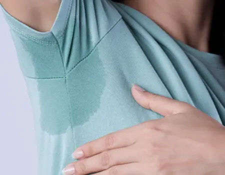 Hyperhidrosis