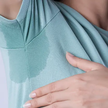 Hyperhidrosis