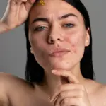Monsoon Skin Care Hacks by Dr. Surabhi Sharma