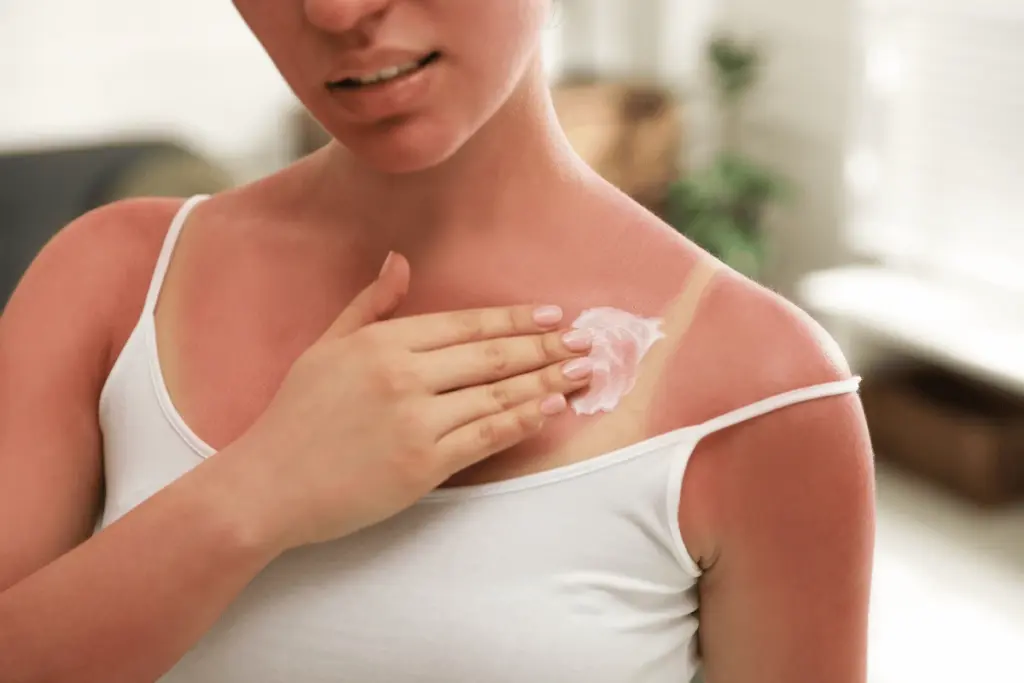 Sun Exposure or Tanning Before laser hair removal skin