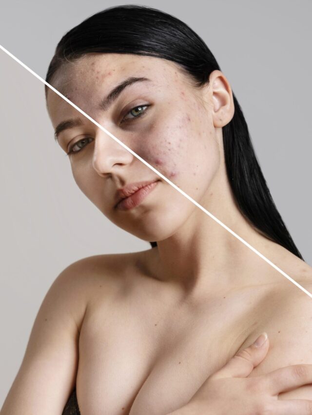 10 Amazing Facts About HydraFacial You Need to Know!