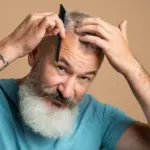 Hair Genex treatment in Delhi hair regrowth