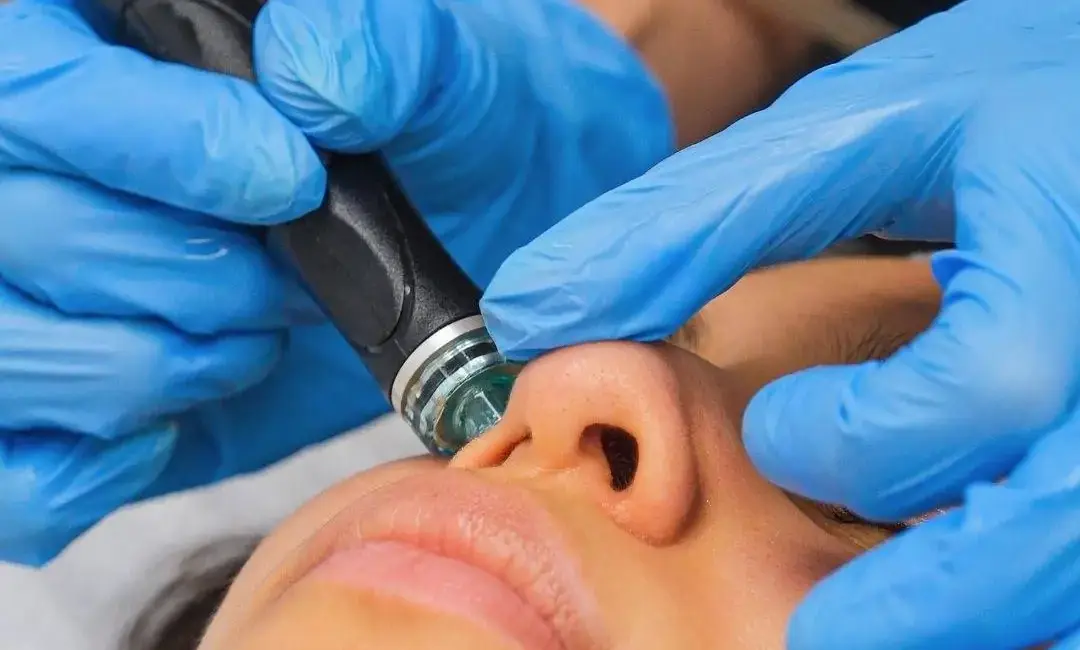 benefits of hydrafacial