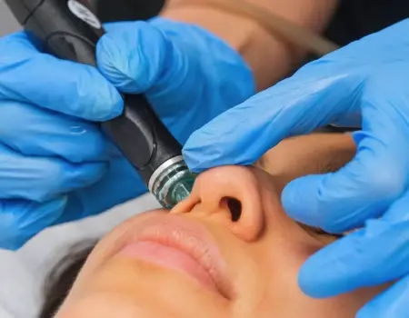 benefits of hydrafacial