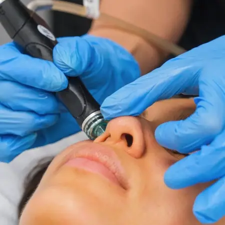 benefits of hydrafacial