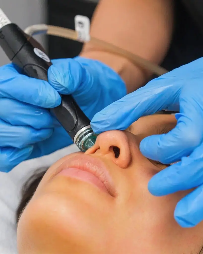 benefits of hydrafacial