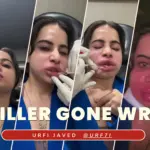Urfi Javed: Uorfi Javed gets her lip fillers dissolved after 9 years, shares pictures of her swollen face