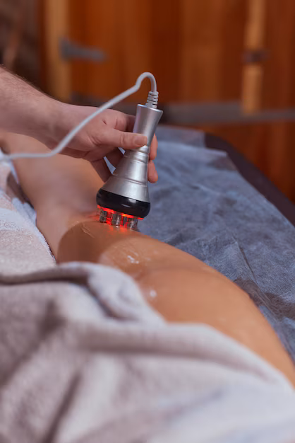 Cavitation machine used for inch loss treatment at Paradise Wellness Delhi