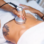 Ultrasound cavitation therapy being performed on abdomen area