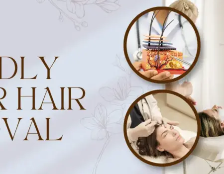 skin friendly lase hair removal